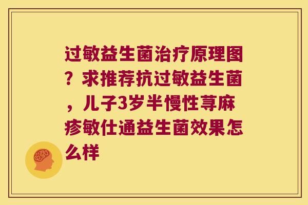 过敏益生菌治疗原理图？求推荐抗过敏益生菌，儿子3岁半慢性荨麻疹敏仕通益生菌效果怎么样