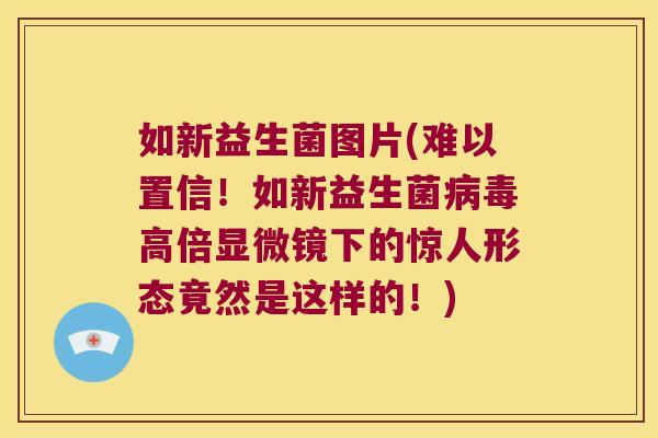 如新益生菌图片(难以置信!如新益生菌高倍显微镜下的惊人形态竟然是这样的!) 如新益生菌图片(难以置信!如新益生菌高倍显微镜下的惊人形态竟然是这样的!)