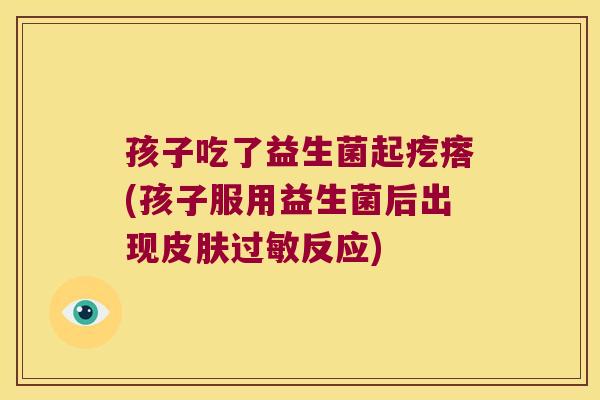 孩子吃了益生菌起疙瘩(孩子服用益生菌后出现反应) 孩子吃了益生菌起疙瘩(孩子服用益生菌后出现反应)